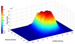 Extrinsic muscle forces affect ankle loading before and after total ankle arthroplasty